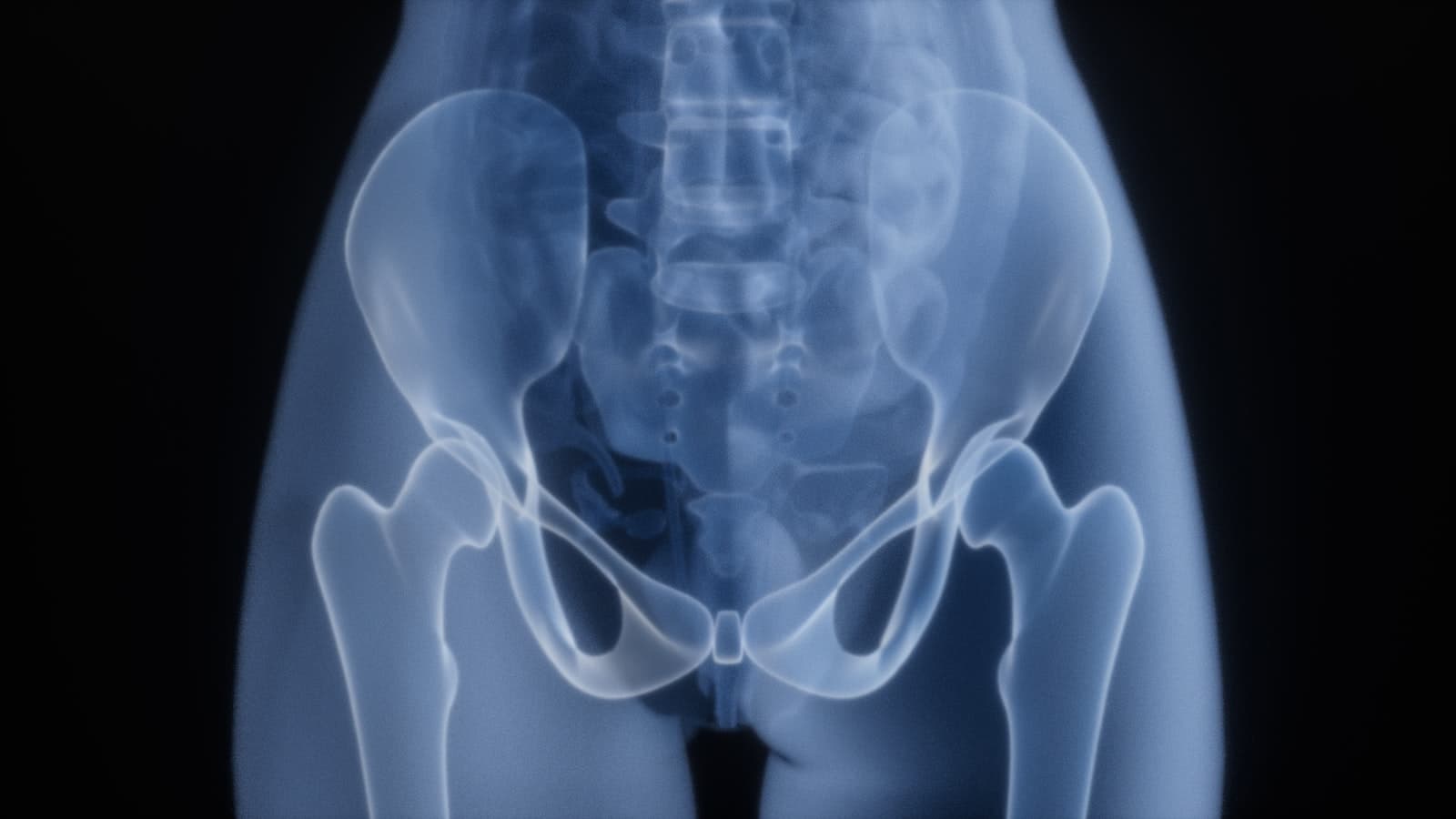 X-ray of human pelvis and hips