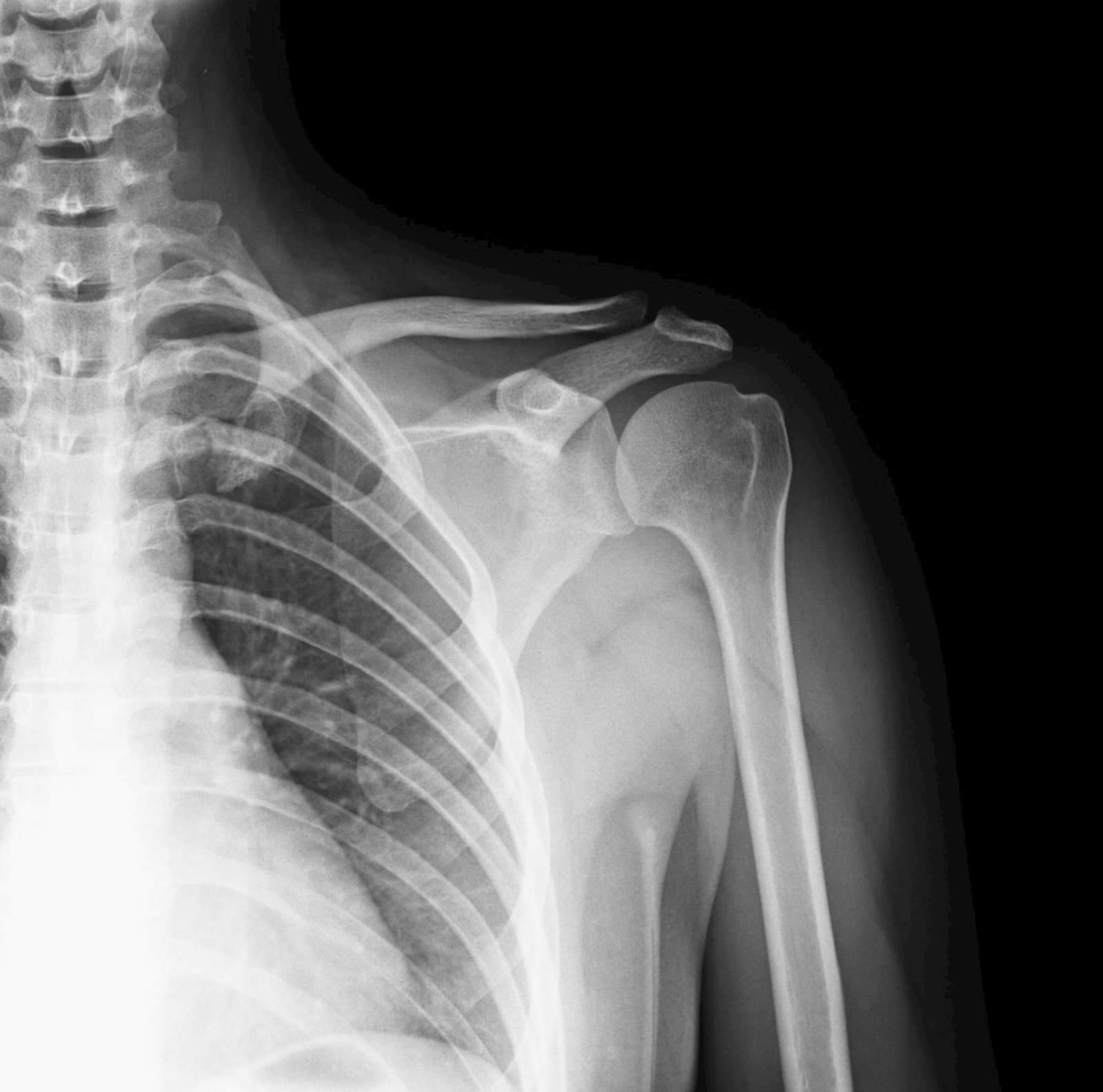X-ray showing trauma assessment